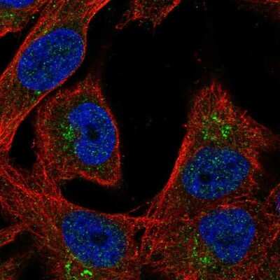 Immunocytochemistry/ Immunofluorescence: Lgi4 Antibody [NBP2-30423]