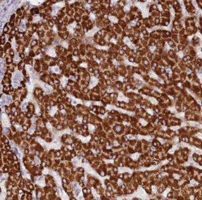 Immunohistochemistry: Lgi4 Antibody [NBP2-30545]