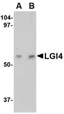 Western Blot: Lgi4 AntibodyBSA Free [NBP1-76380]