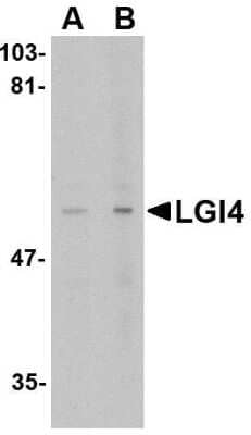 Western Blot: Lgi4 AntibodyBSA Free [NBP1-76381]