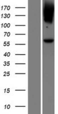 Western Blot: Lgi4 Overexpression Lysate [NBP2-05578]