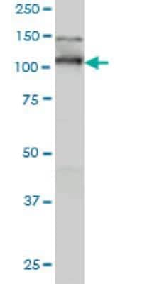 Western Blot: Lgl1 Antibody (5G2) [H00003996-M01]