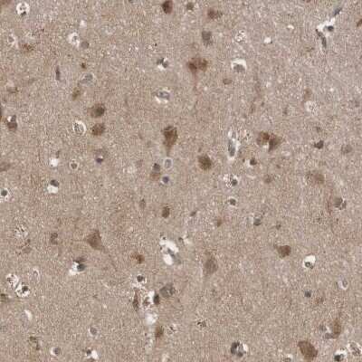 Immunohistochemistry-Paraffin: Lgl1 Antibody [NBP1-84078]