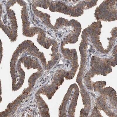 Immunohistochemistry-Paraffin: Lgl1 Antibody [NBP1-84078]