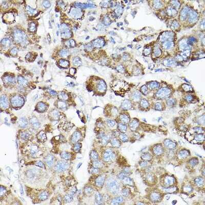 Immunohistochemistry-Paraffin: Lgl1 Antibody - Azide and BSA Free [NBP3-15981]