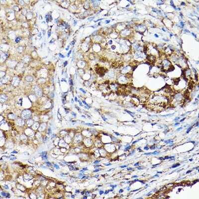 Immunohistochemistry-Paraffin: Lgl1 Antibody - Azide and BSA Free [NBP3-15981]
