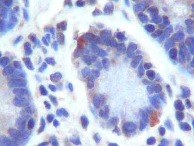 Immunohistochemistry: Lgr5/GPR49 Antibody - BSA Free [NBP1-28904]