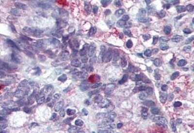 Immunohistochemistry-Paraffin: Lgr5/GPR49 Antibody - BSA Free [NLS1236]