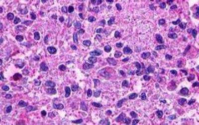 Immunohistochemistry-Paraffin: Lgr5/GPR49 Antibody - BSA Free [NLS1236]