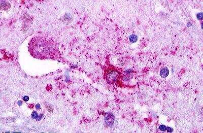 Immunohistochemistry-Paraffin: Lgr5/GPR49 Antibody - BSA Free [NLS1236]