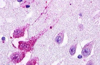 Immunohistochemistry-Paraffin: Lgr5/GPR49 Antibody - BSA Free [NLS1236]