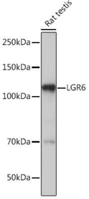 Western Blot: Lgr6 Antibody (8J2J10) [NBP3-16758]
