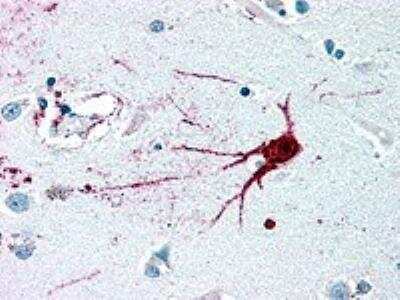 Immunohistochemistry-Paraffin: Lgr6 Antibody - BSA Free [NLS442]