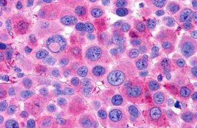 Immunohistochemistry-Paraffin: Lgr6 Antibody - BSA Free [NLS442]