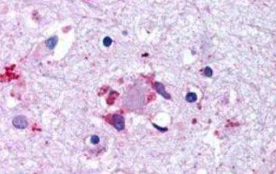 Immunohistochemistry-Paraffin: Lgr6 Antibody - BSA Free [NLS442]