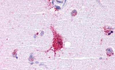 Immunohistochemistry-Paraffin: Lgr6 Antibody - BSA Free [NLS442]