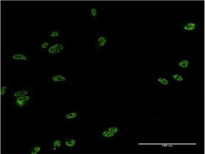 Immunocytochemistry/ Immunofluorescence: Lhx4 Antibody (1D6) [H00089884-M15]