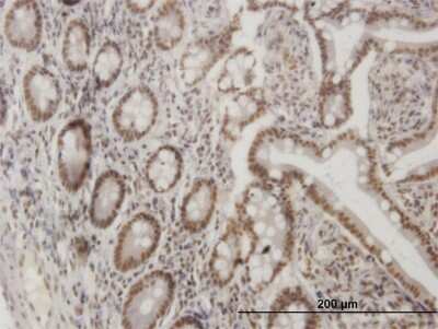 Immunohistochemistry-Paraffin: Lhx4 Antibody (1D6) [H00089884-M15]
