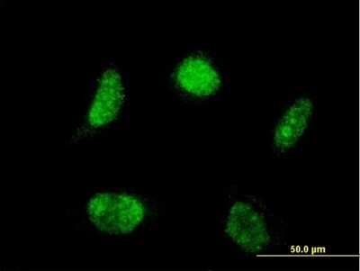 Immunocytochemistry/ Immunofluorescence: Lhx4 Antibody (2B12) [H00089884-M03]