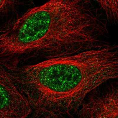 Immunocytochemistry/ Immunofluorescence: Lhx4 Antibody [NBP2-56985]