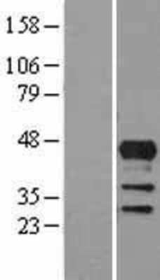 Western Blot: Lhx4 Overexpression Lysate [NBL1-12516]