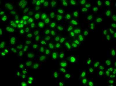 Immunocytochemistry/ Immunofluorescence: Lhx8 Antibody - BSA Free [NBP3-04542]