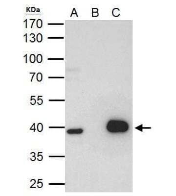 Immunoprecipitation: Lhx8 Antibody [NBP1-32840]