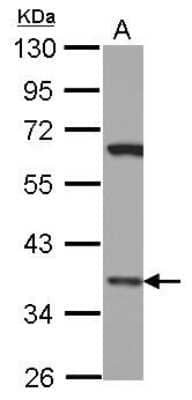 Western Blot: Lhx8 Antibody [NBP2-19350]