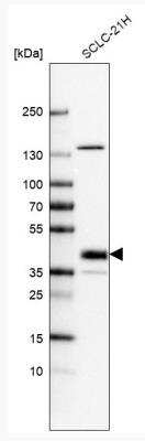 Western Blot: Lhx8 Antibody [NBP2-57782]