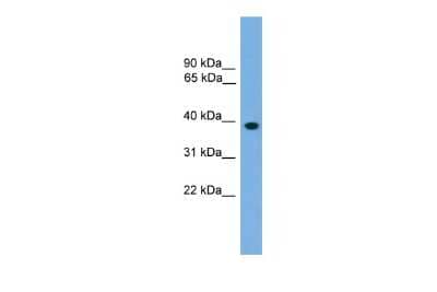 Western Blot: Lhx8 Antibody [NBP2-87724]