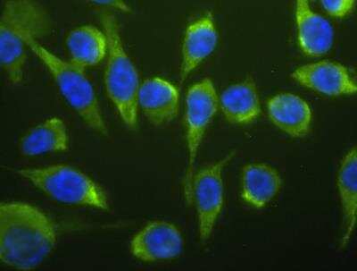 Immunofluorescence: Lightning-Link (R) Fluorescein Antibody Labeling Kit [707-0010]