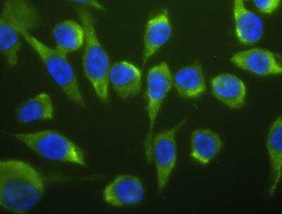 Immunofluorescence: Lightning-Link (R) Fluorescein Antibody Labeling Kit [707-0030]