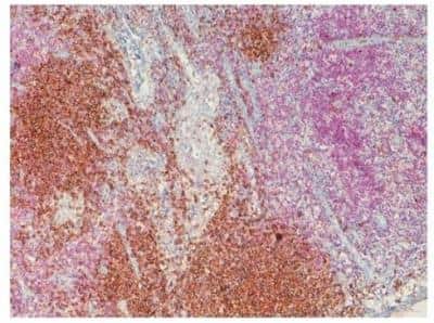Immunohistochemistry: Lightning-Link (R) HRP Antibody Labeling Kit [701-0000]