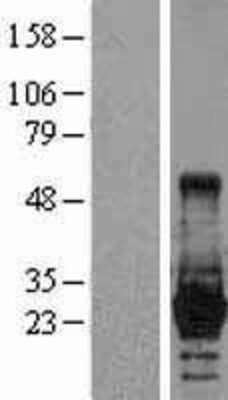 Western Blot: LIN-28A Overexpression Lysate [NBL1-12541]