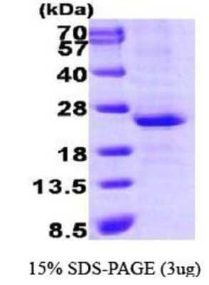 SDS-PAGE: Recombinant Human LIN-28A His Protein [NBP1-30275]