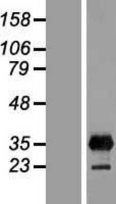 Western Blot: LIN-28B Overexpression Lysate [NBP2-08934]