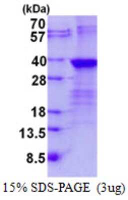 SDS-PAGE: Recombinant Human LIN-28B His Protein [NBP2-23196]