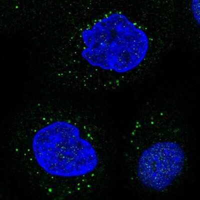 Immunocytochemistry/ Immunofluorescence: Lipase A Antibody [NBP2-47397]