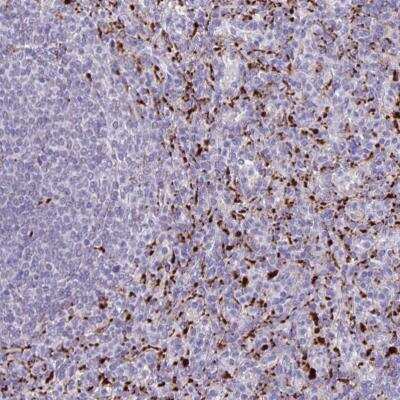 Immunohistochemistry-Paraffin: Lipase A Antibody [NBP2-47397]