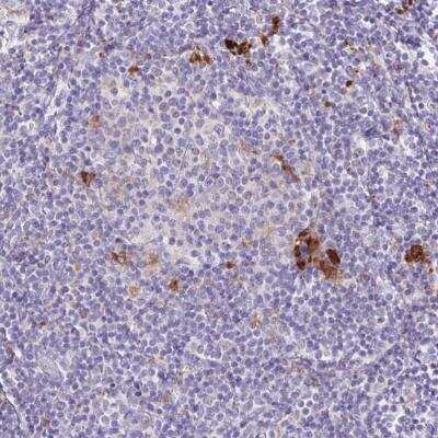 Immunohistochemistry-Paraffin: Lipase A Antibody [NBP2-47397]