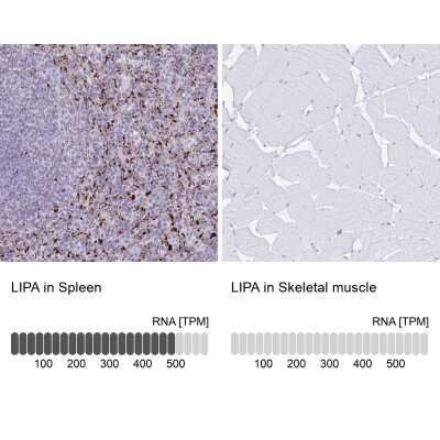 Immunohistochemistry-Paraffin: Lipase A Antibody [NBP2-47397]