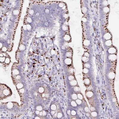 Immunohistochemistry-Paraffin: Lipase A Antibody [NBP2-47397]