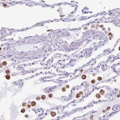 Immunohistochemistry-Paraffin: Lipase A Antibody [NBP2-47397]