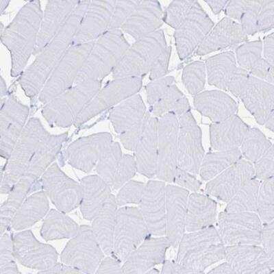 Immunohistochemistry-Paraffin: Lipase A Antibody [NBP2-47397]
