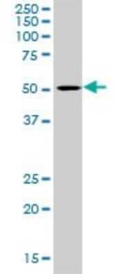 Western Blot: Lipase A Antibody [H00003988-D01P]