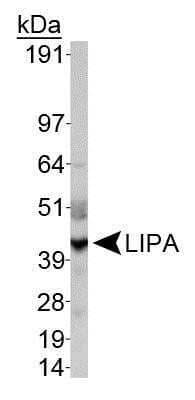 Western Blot: Lipase A AntibodyBSA Free [NBP1-54155]