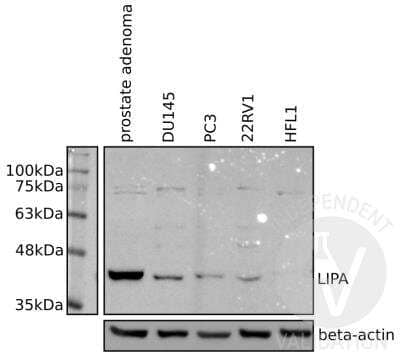 Western Blot: Lipase A AntibodyBSA Free [NBP1-54155]