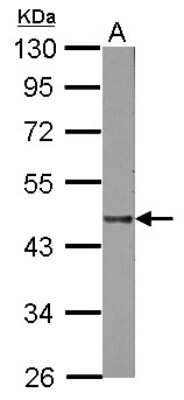 Western Blot: Lipase A Antibody [NBP2-19360]