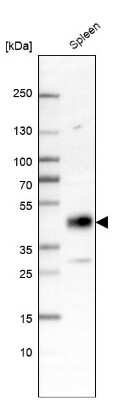 Western Blot: Lipase A Antibody [NBP2-47397]