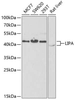 Western Blot: Lipase A AntibodyBSA Free [NBP3-03229]